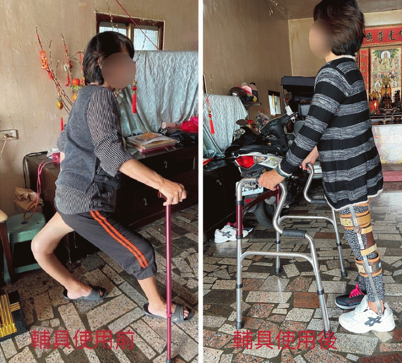輔具適配更方便 助行動不便者找回行動力
