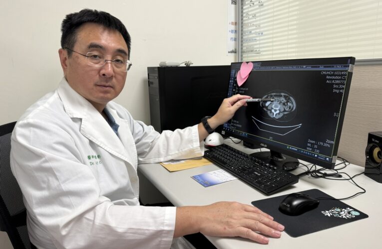 52歲女性定期健檢揪出胃癌丨達文西手術助病患順利康復