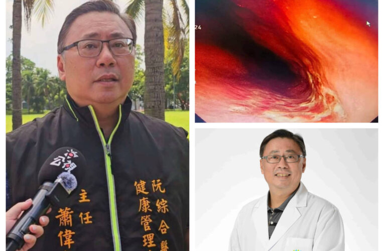 吞藥配水太少竟險釀禍！阮綜合醫揭〈食道潰瘍〉幕後驚人真相