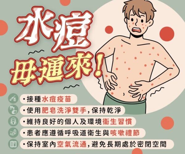 北高雄某高中發生水痘群聚事件　衛生局介入防疫管控疫情已獲控制