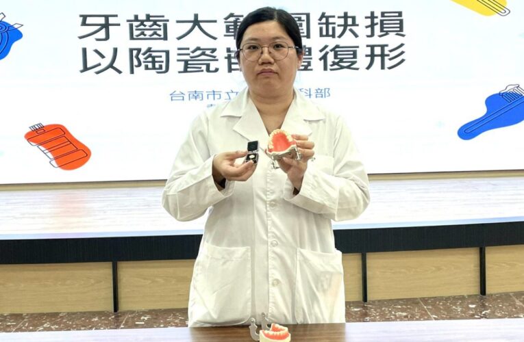 蛀牙齒質缺損面積大別只靠補牙   陶瓷嵌體兼顧美觀與實用