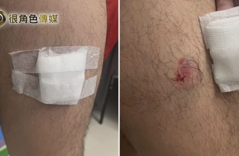 痛！這真的是被「反咬了一口」 高雄女騎士被警開單失控咬警大腿
