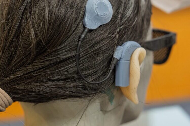 翁突發性感音神經性聽損 植入人工耳蝸改善