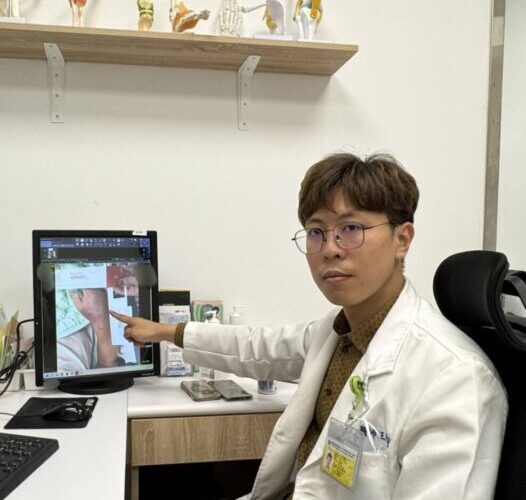 魚刺傷右手腫了2倍大　高雄秀傳及時救治讓患者免於截肢