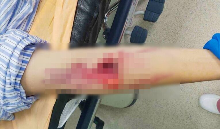 少年騎車自摔脾臟碎裂　彰基整合創傷團隊成功搶救