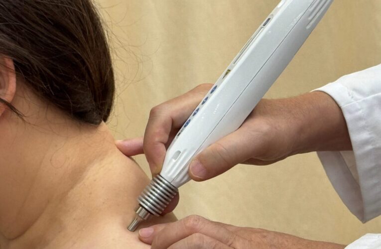 中醫針灸邁入無痛新時代　北市聯醫林森院區導入雷射療法守護市民健康