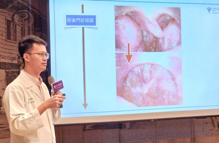 男子長期打鼾 微創鼻竇及鼻中膈鼻道成型手術 通氣