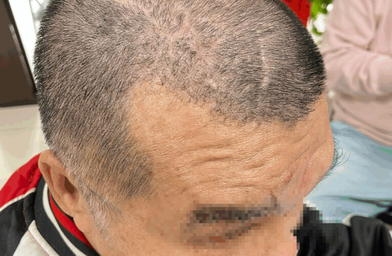 工人遇職災失明控公司倉促和解　工程公司：該員未繫安全帶、補償均備妥