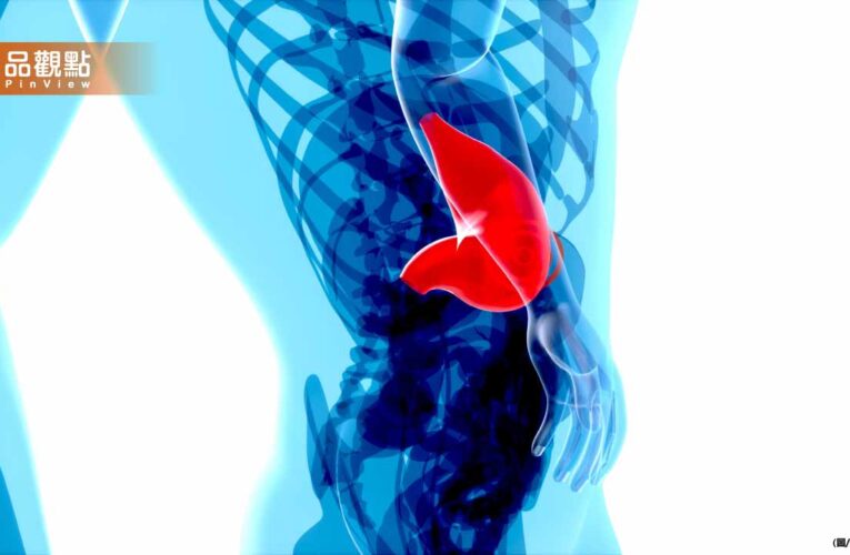 30歲女吃大餐爆急性胰臟炎2天亡！三酸甘油酯飆破4000