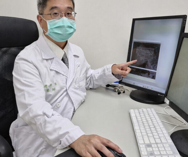 年輕女性騎飛輪後茶色尿　醫提醒當心急性橫紋肌溶解症