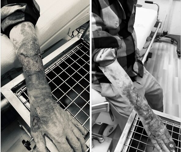 老翁被陳姓男子毆打成傷           警傳喚陳男到案訊後送辦