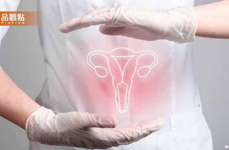 結紮「能降低卵巢癌風險？」　婦產科醫這樣說