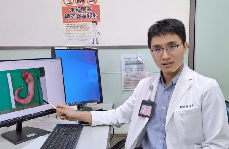 嘉基推SASI新術式　助大叔年甩肉57公斤　糖尿病改善率達九成