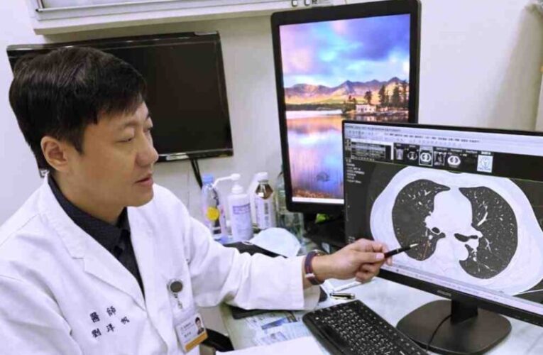 0.7公分結節藏肺葉深處　術後病理報告證實第一期侵襲性肺腺癌